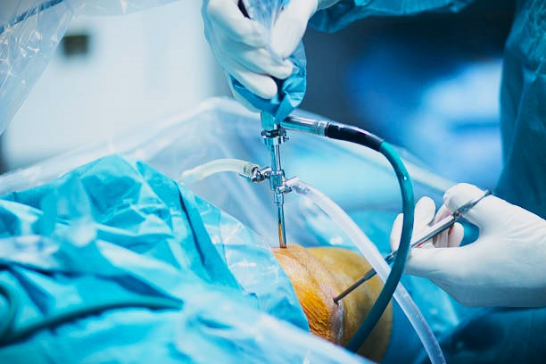 best arthroscopic surgeon in kopar khairane